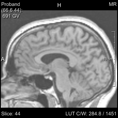 ../../../Modules/Macros/Viewers/mhelp/Images/Screenshots/View2D.Viewer.png