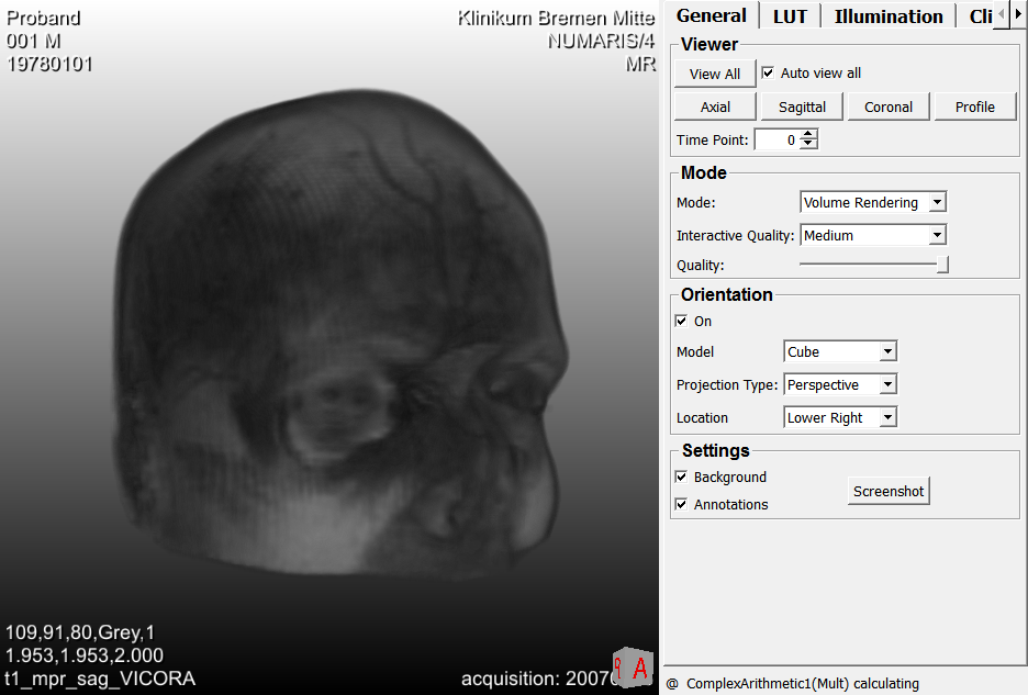 ../../../Modules/Macros/Viewers/mhelp/Images/Screenshots/View3D.View3D.png