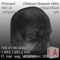 ../../../Modules/Macros/Viewers/mhelp/Images/Screenshots/View3D.Viewer.png