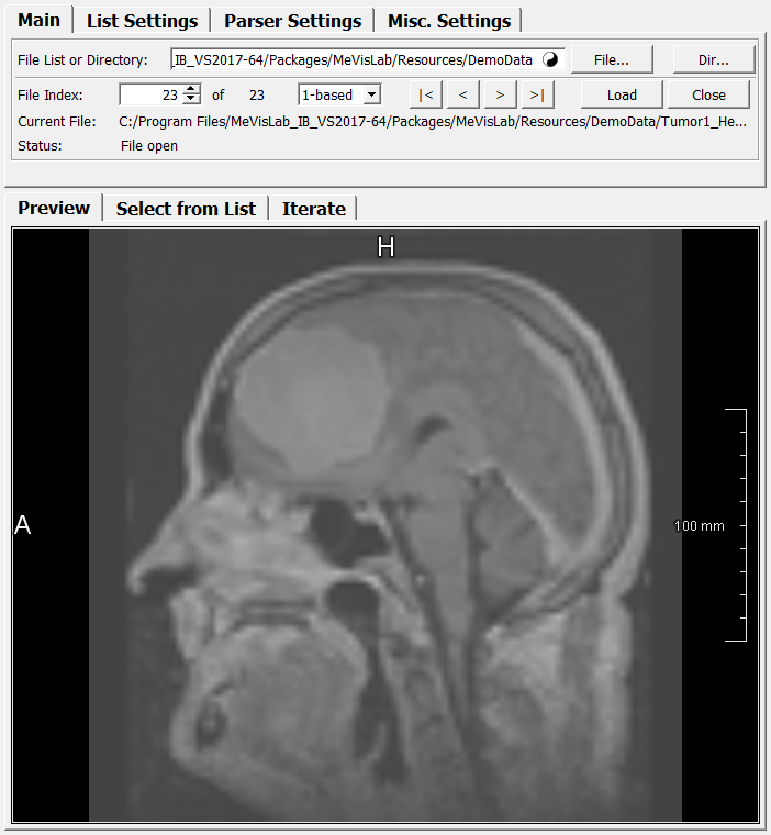 ../../../Projects/ImageLoadMulti/Modules/mhelp/Images/Screenshots/ImageLoadMulti._default.png